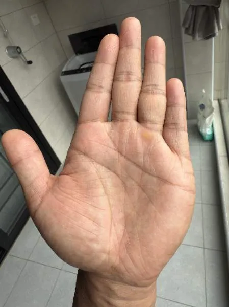 80后男，请老师看看
